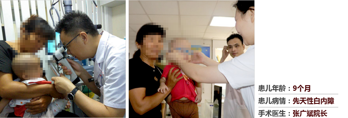 患兒年齡：9個(gè)月，患兒病情：先天性白內(nèi)障，手術(shù)醫(yī)生：張廣斌院長(zhǎng)
