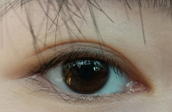 倒睫怎么辦？