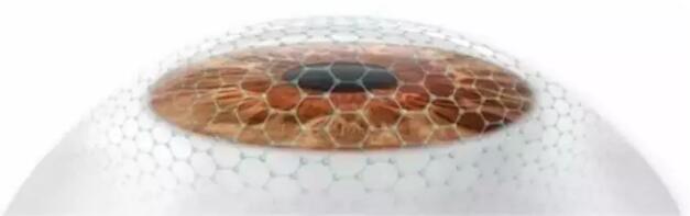 全激光近視眼手術