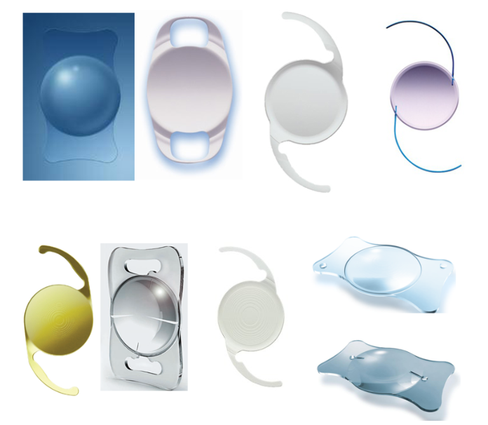 白內(nèi)障手術(shù)